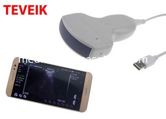 جهاز الموجات فوق الصوتية اللاسلكية Teveik Medical Wireless Probe Portable Wifi Ultrasound Doppler Machine